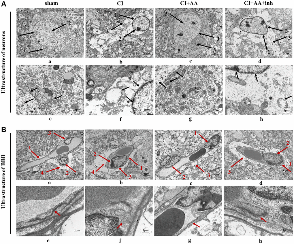 Alisol A protected the neurovascular ultrastructure in the hippocampal CA1 region. (A) Changes in neuronal ultrastructure are indicated by black arrows. (a) 1: The nuclear membrane structure of the neurons was intact and clear; 2: Chromatin distributed evenly; 3: Normal structural organelles were abundant within the cytoplasm. (b) 1: Incoherent nuclear membrane structure; 2: Chromatin condensation, decreased and edge aggregation; 3: Most of the organelles disappeared, and the cytoplasm was empty. (c) 1: The nuclear membrane is relatively complete, and the edge is clear; 2: More normal chromatin; 3: The organelles can be seen in the cytoplasm. (d) 1: Discontinuous and indistinct nuclear membrane structure; 2: Less chromatin; 3: Partial dissolution and disappearance of intracytoplasmic organelles. (a–d) Magnification of the microphotograph is 2500X. Scale bar is 5 μm; (e–h) Magnifications of the microphotograph are 8000X. Scale bar is 1 μm. (B) Changes in BBB ultrastructure as indicated by the red arrow. (a) 1: Clear capillary structures; 2: Close contact of the endothelial cells with the basement membrane; 3: Continuous endothelial cells; 4: End-feet of astrocyte surrounding the basal membrane. (b) 1: Capillary structure enhancement; 2: Edema fluid between the endothelial cells and the basement membrane; 3: Discontinuity of endothelium. 4: Marked edema of astrocytic end-foot processes and vacuolization. (c) 1: The edema between endothelial cells and the basal layer was weakened; 2: The endothelium was more continuous; 3: Vacuolization of astrocytic end-foot process edema was alleviated. (d) 1: There is edema between the endothelial cells and the basement membrane; 2: The endothelium is discontinuous and interrupted; 3: Perivascular astrocytic end-foot process edema was obvious and still showed vacuolar changes. (a–d) Magnification of the microphotograph is 2500X. Scale bar is 5 μm; (e–h) Magnifications of the microphotograph are 8000X. Scale bar is 1 μm. n = 3.