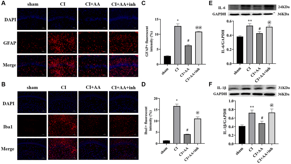 Alisol A inhibited the expression of astrocytes, microglia, IL-6 and IL-1β after CI. (A) Representative image of GFAP in the hippocampal CA1 region by immunofluorescence staining. (B) Representative image of Iba1 in the hippocampal CA1 region by using immunofluorescence staining. 200×, scale bar is 100 μm. (C) Quantitative analysis of GFAP fluorescence intensity. (D) Quantitative analysis of Iba1 fluorescence intensity, n = 3. (E) Western blot showing the expression of IL-6 and quantitative analysis of the ratio of IL-6 to GAPDH. (F) Western blot showing the expression of IL-1β and quantitative analysis of the ratio of IL-1β to GAPDH, n = 4. Data are shown as the mean ± SD. *P **P #P @P @@P 