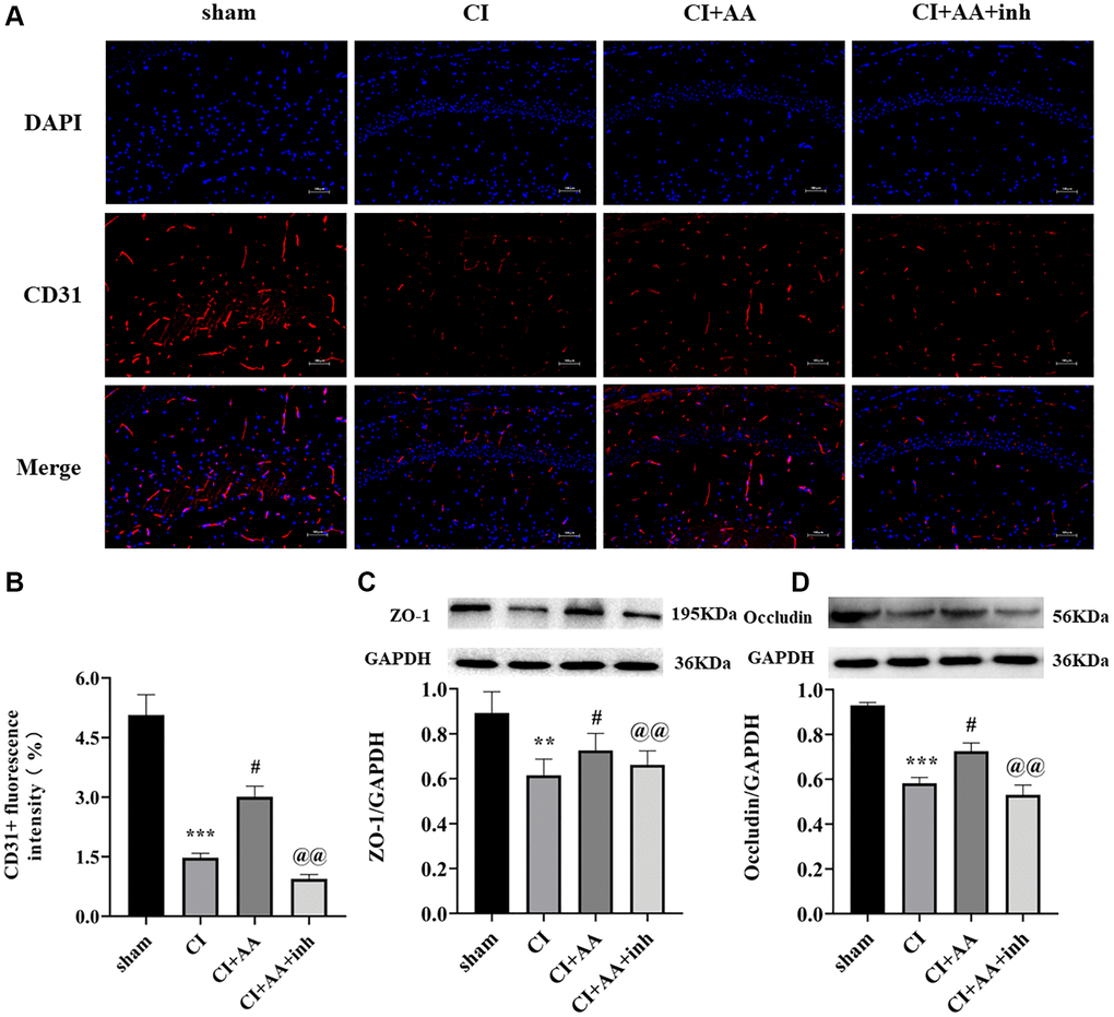 Alisol A upregulated the expression of CD31, ZO-1 and Occludin after CI. (A) Representative image of CD31 in the hippocampal CA1 region by using immunofluorescence staining. 200×, scale bar is 100 μm. (B) Quantitative analysis of CD31 fluorescence intensity. n = 3. (C) Western blot showing the expression of ZO-1 and quantitative analysis of the ratio of ZO-1 to GAPDH. (D) Western blot showing the expression of Occludin and quantitative analysis of the ratio of Occludin to GAPDH, n = 4. Data are shown as the mean ± SD. **P ***P #P @@P 