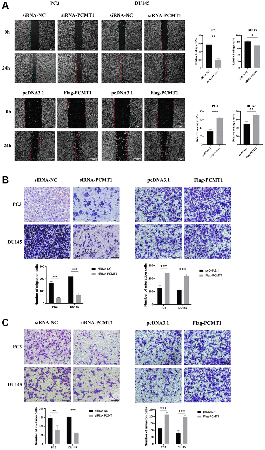 Impact of PCMT1 inhibition on the migration and invasion of PCa cell lines. (A) Effect of PCMT1 inhibition on PCa cell migration measured by wound-healing assay (×40). (B) PCa cell migration ability was assessed by a transwell migration assay (×200). (C) PCa cell invasion ability was examined by a transwell invasion assay (×200). Data are expressed as mean ± SD of at least three experiments. *P **P ***P 