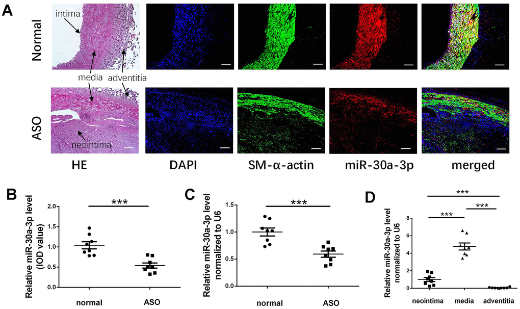MicroRNA-30a-3p decreased in the restenotic ASO artery. (A) SM-α-actin and microRNA-30a-3p were stained in ASO and normal vascular sections (n=8); We used DAPI to stain the nuclei. (A, B) The IOD of the microRNA-30a-3p-stained vascular sections was calculated and compared. (C) Relative microRNA-30a-3p levels in ASO and normal arteries (qRT-PCR, n=8). (D) Relative microRNA-30a-3p levels in the three layers of ASO arteries (qRT-PCR, n=8). Scale, 200 μm; ***=0.001.