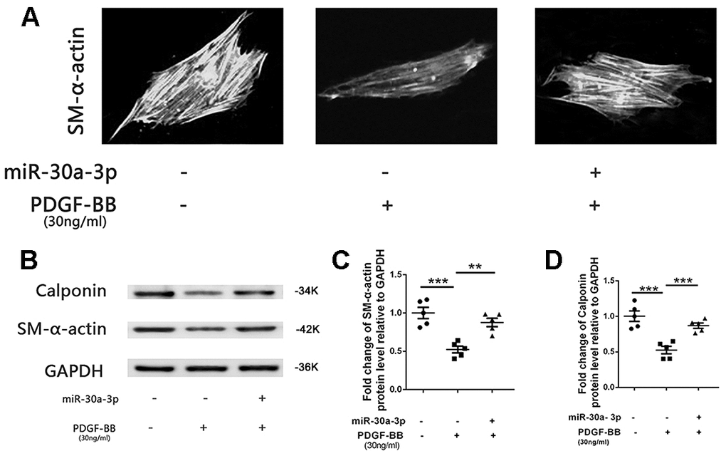 The VSMC phenotypic switch was suppressed by microRNA-30a-3p. (A) PDGF-BB stimulation promoted VSMC phenotypic switching from contractile conditions to synthetic conditions, and microRNA-30a-3p upregulation suppressed this process. (B–D) MicroRNA-30a-3p suppressed VSMC phenotypic protein (SM-α-actin and calponin) switching. **=0.005, ***=0.001.