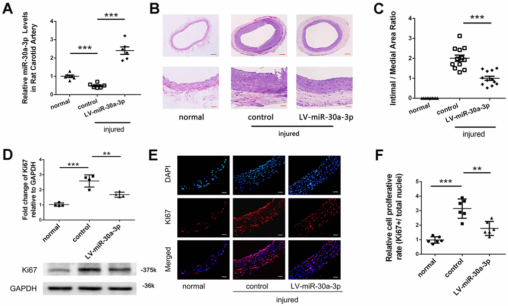 MicroRNA-30a-3p inhibited neointima formation. (A) LV-miR-30a-3p increased microRNA-30a-3p levels in the balloon injury model (qRT-PCR, n=6). (B, C) Neointima formation was inhibited by LV-miR-30a-3p (n=12). LV-miR-30a-3p suppressed VSMC proliferation as shown by the Ki67 analysis (D) (WB, n=4) and (E, F) (IF, n=6). Scale, 50 μm (bottom of B, E), 200 μm (top of B); **=0.005, ***=0.001.