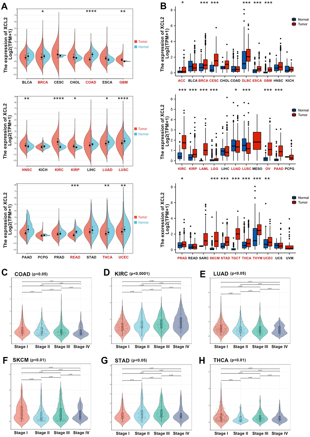 The expression levels of XCL2 mRNA in pan-cancer. (A) The mRNA expression levels of XCL2 in 21 types of tumors tissues and adjacent normal tissues from the TCGA database; (B) Expression of XCL2 between the 33 cancers and normal tissues in unpaired sample analysis; (C–H) The correlation between the XCL2 expression and cancer stages in COAD, KIRC, LUAD, SKCM, STAD, and THCA (*P 