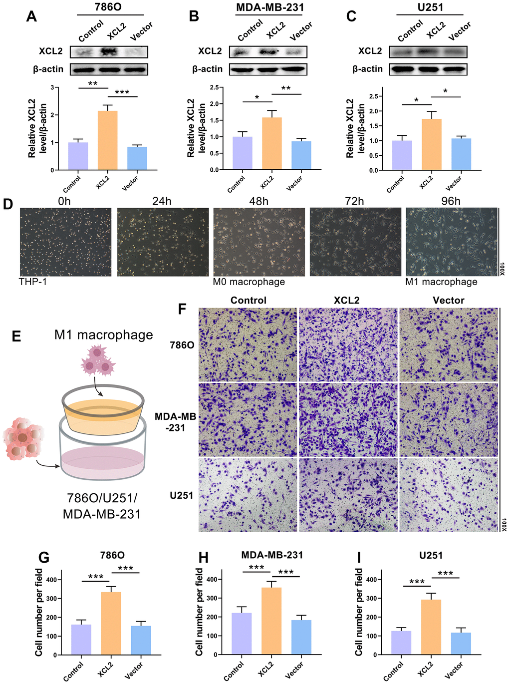 M1 macrophage migration is mediated by XCL2. (A–C) The transduction outcomes of XCL2 in 786O, MDA-MB-231, and U251 are confirmed using western blotting. (D) The M1 macrophages induction procedure and morphology. (E) The schematic design shows the coculture of 786O, MDA-MB-231, or U251 cells with M1 macrophages. (F–I) The movement of M1 macrophages in coculture with 786O, MDA-MB-231, and U251 cells that have been XCL2-OE and XCL-NC transfected. The magnification under the microscope is shown as marked in the figure. *P 