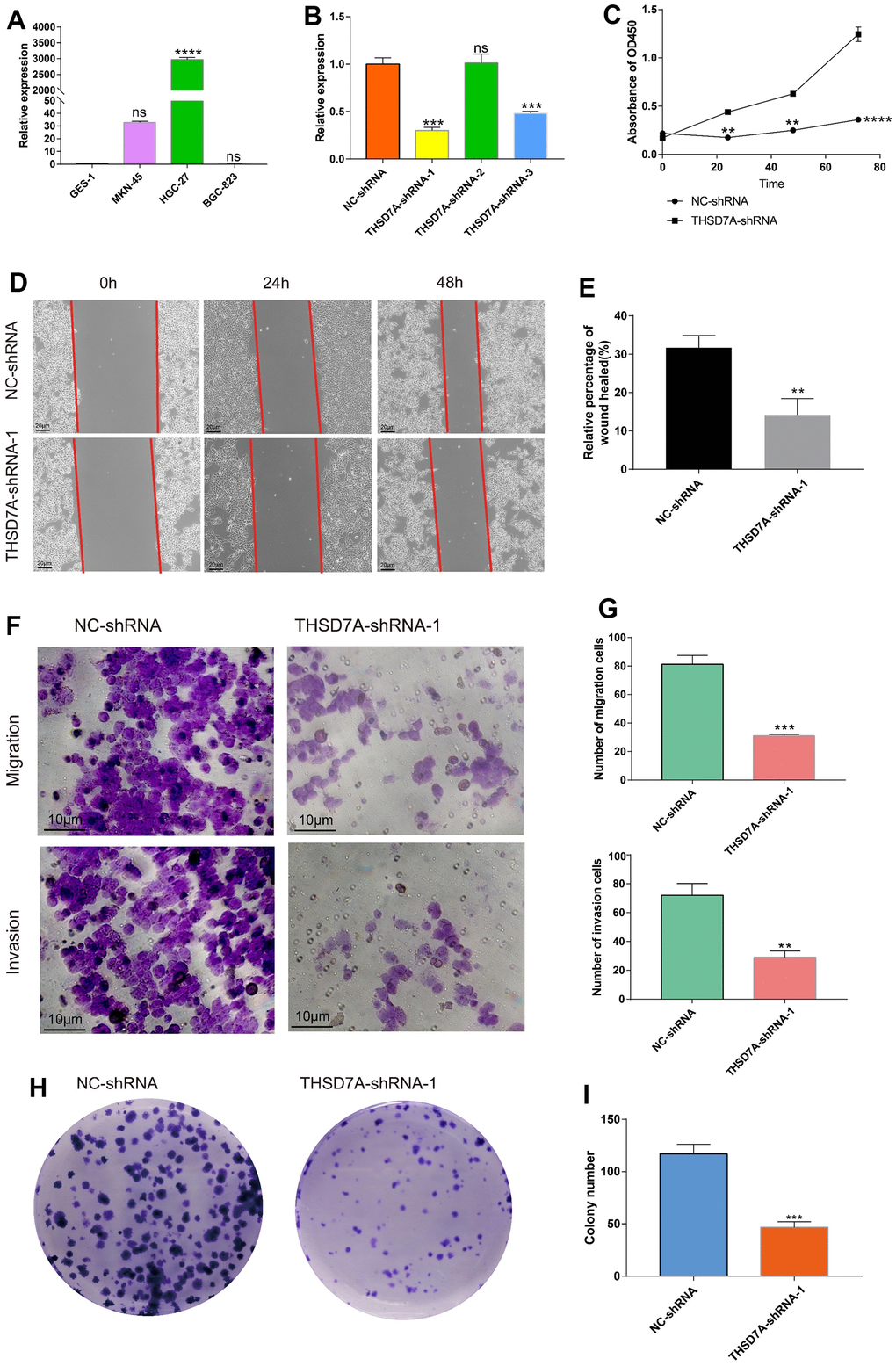 Effects of THSD7A gene deletion on gastric cancer cell proliferation and invasion. (A) The results of the qRT-PCR analysis of THSD7A expression in normal gastric cells and gastric cancer cells. (B) In HGC-27 cells, THSD7A expression is downregulated in the shRNA group, with the THSD7A-shRNA-1 group being downregulated most significantly. (C) CCK-8 assay results showing the proliferation and viability of HGC-27 cells following THSD7A knockout. (D, E) Wound-healing assay results showing the migration ability of HGC-27 cells following THSD7A knockout (scale bar = 20 μm). (F, G) Transwell assay results showing the invasion and migration abilities of HGC-27 cells in the NC-shRNA and THSD7A-shRNA groups (scale bar = 10 μm). (H, I) Colony formation assay results comparing the number of clones of HGC-27 cells between the NC-shRNA and THSD7A-shRNA groups (*: P0.05. Error bars represent standard deviation). (GES-1 and NS-shRNA are the control group).