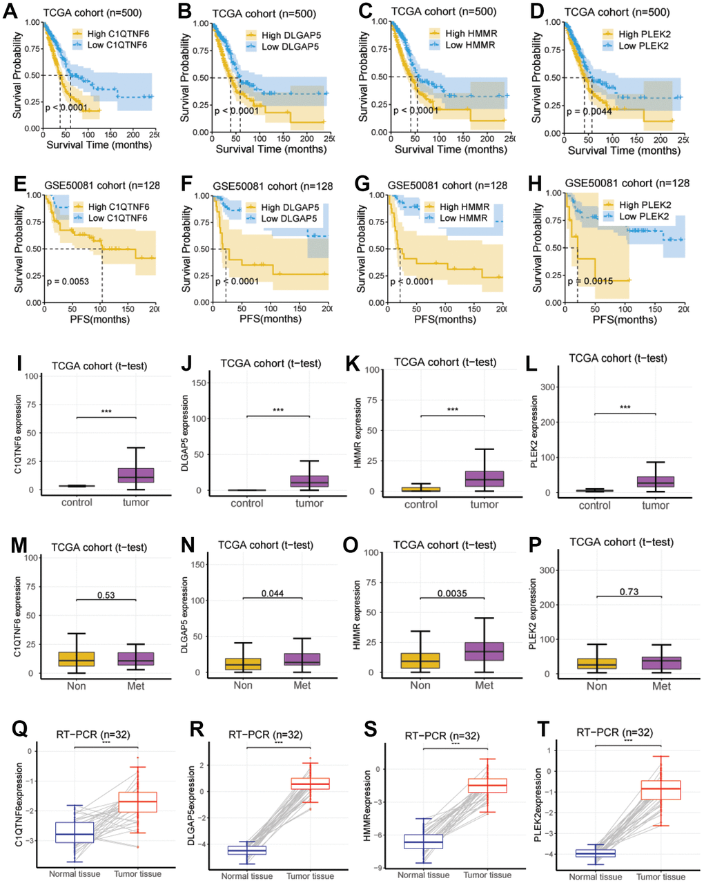 Investigation and validation of the hub genes associated with EMT. (A–D) Four genes, including C1QTNF6, DLGAP5, HMMR, and PLEK2, had a significant survival relevance for OS in the TCGA cohort (log-rank test; P E–H) Four genes, including C1QTNF6, DLGAP5, HMMR, and PLEK2, had a significant survival relevance for PFS in the GSE50081 cohort (log-rank test; P I–L) Consistent with the above findings, the expression of the four genes was enhanced in tumor tissues compared with normal tissues using RNA-seq from the TCGA cohort (P M–P) DLGAP5 and HMMR were significantly upregulated in the lung metastatic foci as compared with non-metastatic lung foci, while C1QTNF6 and PLEK2 were not. (Q–T) C1QTNF6, DLGAP5, HMMR, and PLEK2 were also significantly upregulated in the cancerous tissues as compared with matched normal tissues using RT-PCR for 32 pairs of LUAD tissues and matched normal tissues from our hospital (P 