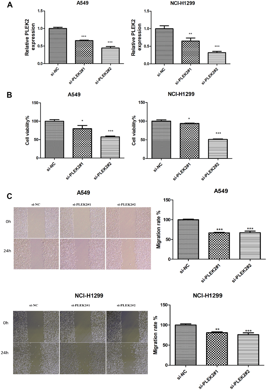 Silencing of PLEK2 reduces the proliferative and migration ability of LUAD cells. (A) The expression of PLEK2 after transfection of si-PLEK2#1, si-PLEK2#2 or si-NC in A549 and NCI-H1299 cells was detected via RT-PCR (P PLEK2 was successfully knocked down in A549 and NCI-H1299 cells. (B) The viability of A549 and NCI-H1299 cells after transfection of si-PLEK2#1, si-PLEK2#2 or si-NC was assessed by CCK-8 assay (P PLEK2 could lead to a reduction in the proliferative ability in A549 and NCI-H1299 cells. (C) The migration of A549 and NCI-H1299 cells after transfection of si-PLEK2#1, si-PLEK2#2 or si-NC was calculated through wound healing assay (P PLEK2 could lead to a reduction in the migration ability in A549 and NCI-H1299 cells.