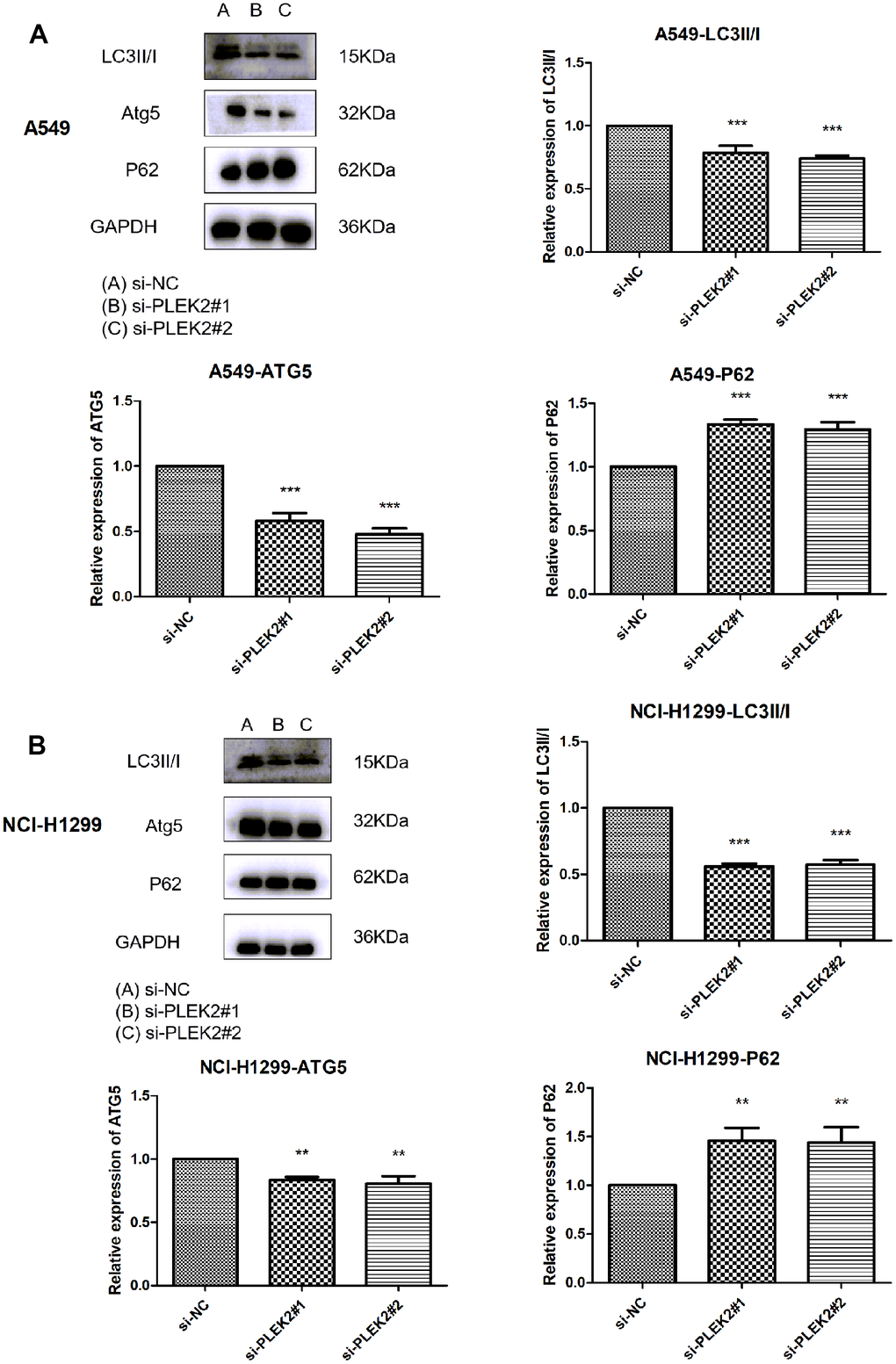 Silencing of PLEK2 prohibits the autophagy of LUAD cells. (A) The protein levels of LC3II/I, ATG5 and P62 in A549 cells after transfection of si-PLEK2#1, si-PLEK2#2 or si-NC were determined by western blotting (P B) The protein levels of LC3II/I, ATG5 and P62 in NCI-H1299 cells after transfection of si-PLEK2#1, si-PLEK2#2 or si-NC were determined by western blotting (P 