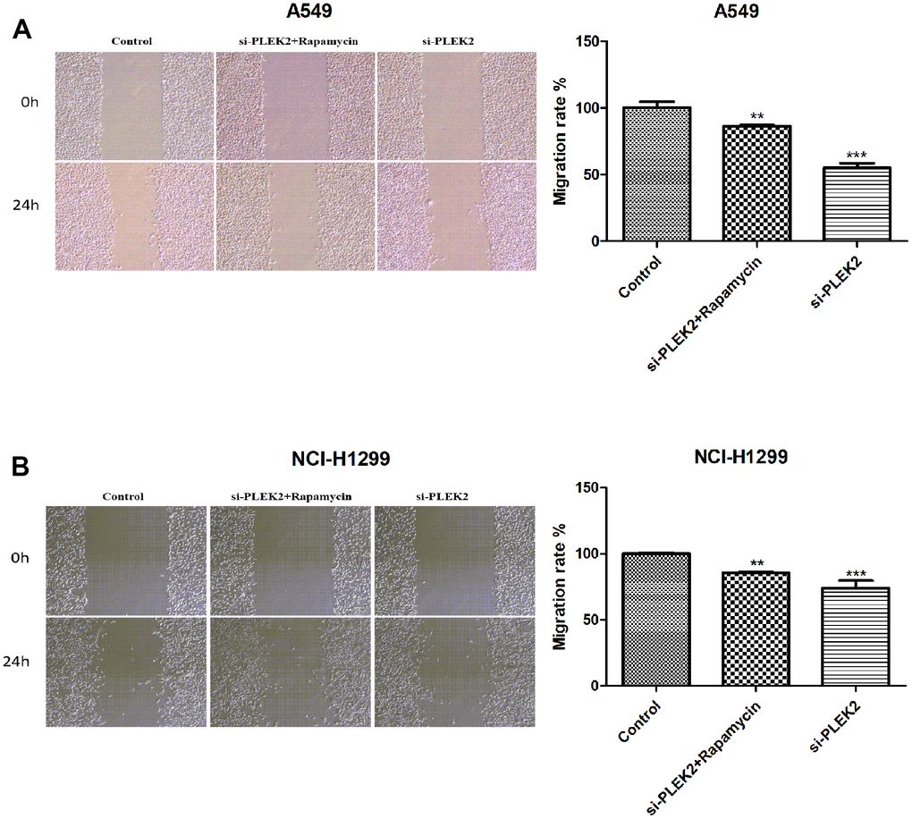 Autophagy activation reverses the suppressive impacts of PLEK2 silencing on the migrated potentials of LUAD cells. (A) Wound healing assays showed that rapamycin treatment could reverse the suppressive impacts of PLEK2 silencing on the migrated potentials of A549 cells (P B) Wound healing assays showed that rapamycin treatment could reverse the suppressive impacts of PLEK2 silencing on the migrated potentials of NCI-H1299 cells (P 