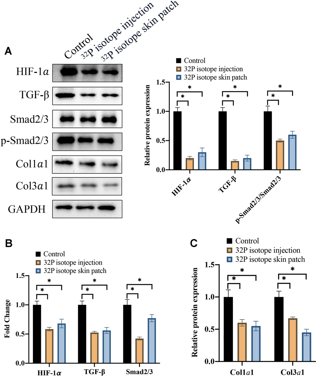 Both 32P isotope injection and skin path significantly inhibited TGF-β/Smad signaling pathway. (A) The protein expression of TGF-β/Smad signaling pathway was measured with western blotting (n=3); (B) The mRNA levels of HIF-1α and TGF-β/Smad signaling pathway were analyzed (n=3); (C) The protein levels of Coll1α1 and Coll3α1 were analyzed (n=3). * indicates p 