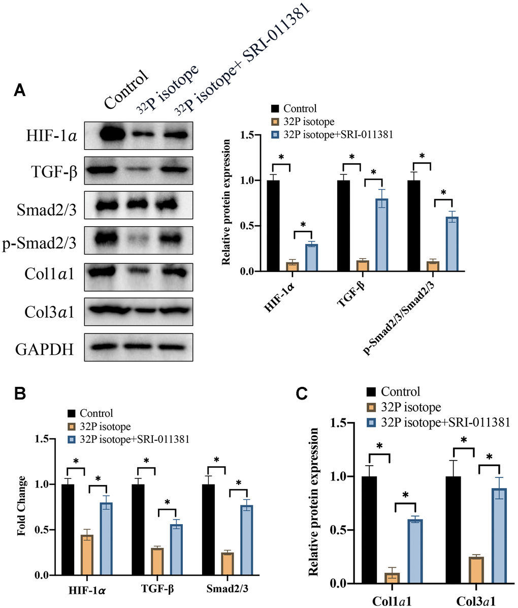 C16PAF markedly reversed the influence of 32P isotope on cell apoptosis of LNCaP cells and EMT process. (A) The protein expression of TGF-β/Smad signaling pathway was measured with western blotting (n=3); (B) The mRNA levels of HIF-1α and TGF-β/Smad signaling pathway were analyzed (n=3); (C) The protein levels of Coll1α1 and Coll3α1 were analyzed (n=3). * indicates p 
