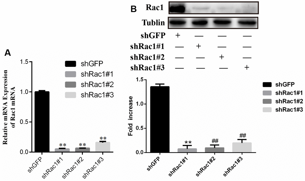 Comparison of Rac1 gene silencing efficiency of shRac1#1, shRac1#2 and shRac1#3 construct for (A) PCR result and (B) western blot result respectively.