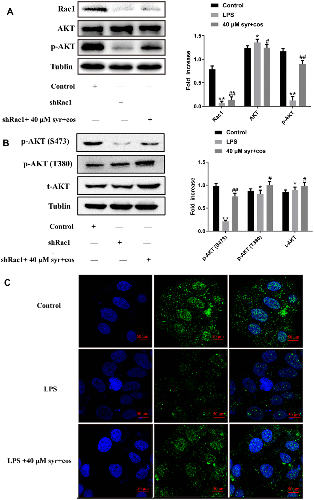(A) The expression of Rac1, AKT, p-AKT proteins respectively. (B) The expression of IKK α/β and IκB, p-IκB proteins respectively. (C) The BrdU immunofluorescence results of p-AKT (100×).