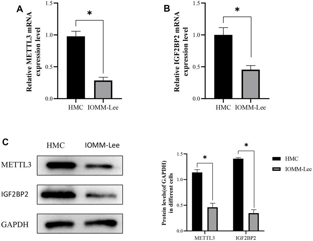 The expression of METTL3 and IGF2BP2 in meningioma cells. (A) The expression level of METTL3 mRNA in meningioma cells. (B) Expression levels of IGF2BP2 mRNA in meningioma cells. (C) Protein expression of METTL3 and IGF2BP2 in meningioma cells. *