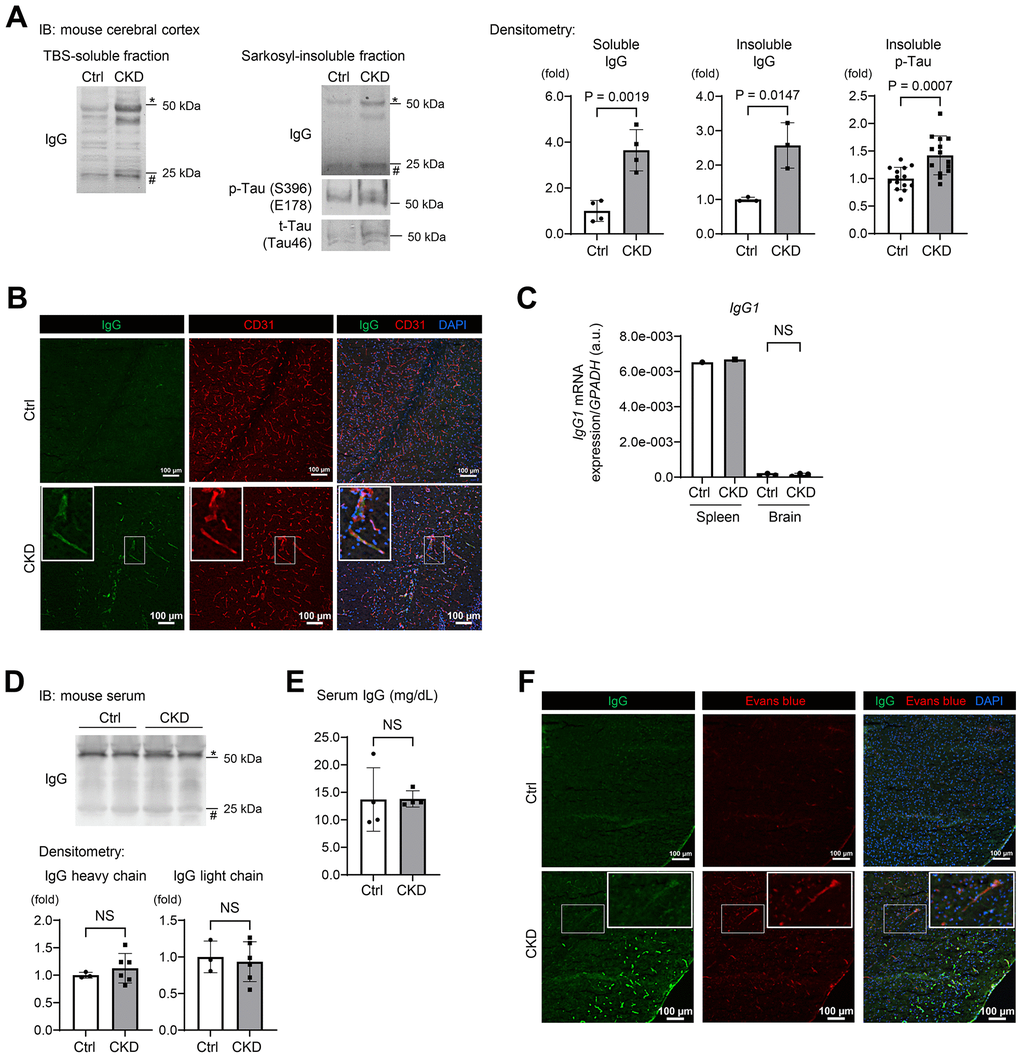 CKD increases a leakage of IgG from cerebral blood vessels to the brain parenchyma in mouse hippocampus and cerebral cortex. (A) Western blotting showed that CKD increased the expressions of soluble IgG (n = 4 per group), insoluble IgG (n = 3 per group), and phosphorylated tau (n = 14 per group) in the sarkosyl-insoluble (aggregated) fraction of the cerebral cortex. (B) The immunofluorescence study with a confocal microscopy showed scattered depositions of IgG in the subendothelial area of the hippocampus parenchyma. (C) Quantitative reverse transcription-PCR showed that the production of IgG1 mRNA in a brain tissue was negligibly low and not different between the CKD and control groups (n =3 per group). (D) Western blotting of serum from CKD and control mice showed no significant differences in IgG concentrations. (E) Measurements of serum IgG by turbidimetric immunoassay did not show differences between CKD and control mice. (F) Exogenously injected Evans-blue fluorescence was detected in CKD mouse cortex using a confocal microscopy, and was partly stained with IgG. Data are presented as mean ± standard deviation of the mean. Normality was assessed with the Shapiro–Wilk test. Statistical significance between the two groups was evaluated using an unpaired t test. P 