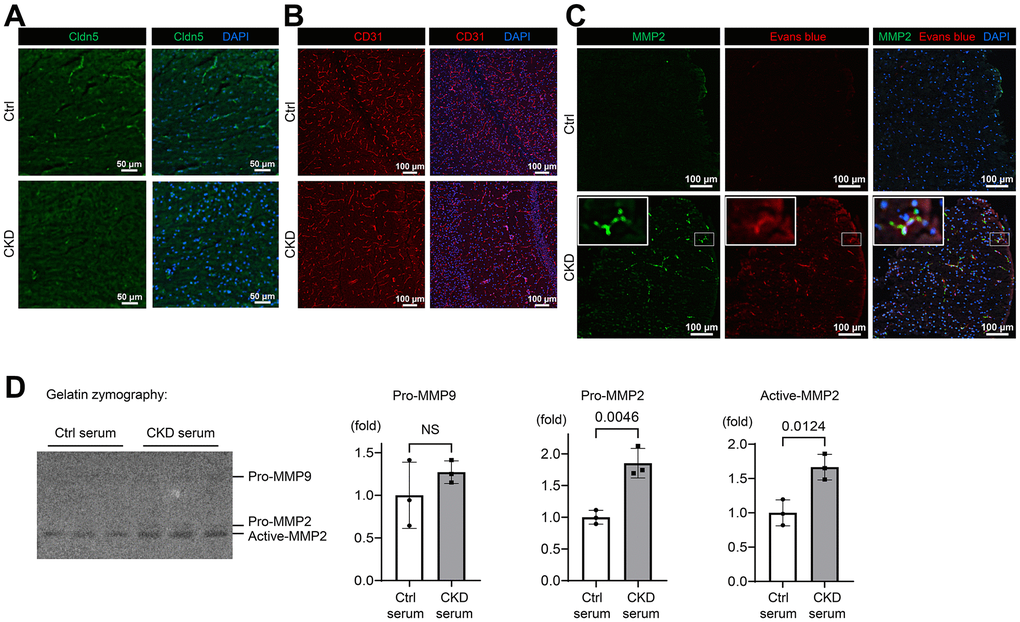 CKD downregulates tight junction, adherens-junction, and basement membrane proteins in mice. (A) Immunofluorescence indicating the staining pattern of claudin-5 in the hippocampus tissue of CKD mice compared to the control group. (B) Immunofluorescence study showing that the adherens-junction protein platelet/endothelial cell adhesion molecule-1 (PECAM-1)/CD31 expression was decreased in the hippocampus of CKD mice compared to the control group. (C) Immunofluorescence study showing that the protein expression of MMP2 was increased in the neocortex tissue of CKD mice, and partly stained with the extravasation of Evans blue dye. (D) We performed gelatin zymography using bEnd.3 cells treated with serum derived from CKD model mice. Uremic serum activated MMP2, but not MMP9 (n = 3 per group). Data are presented as mean ± standard deviation of the mean. Normality was assessed with the Shapiro–Wilk test. Statistical significance between the two groups was evaluated using an unpaired t test. P 