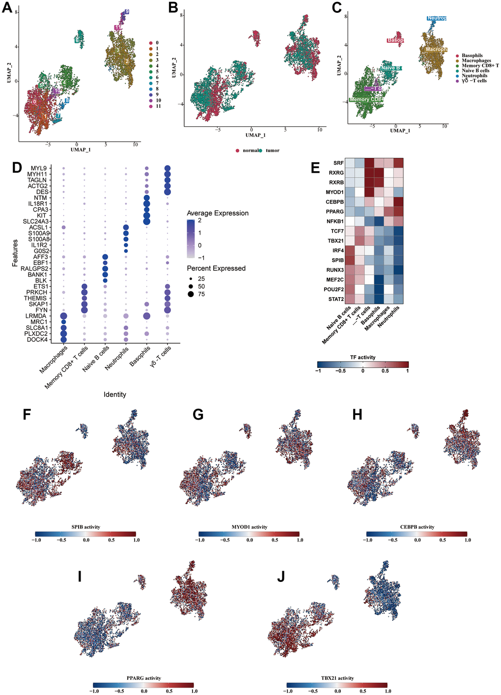 Analysis of subclassification of immune cells. (A) Further dimensionality reduction clustering analysis of the immune cells. (B) The distribution of cells from normal and tumorous tissues in the immune cells. (C) Six cell subtypes were obtained by cell annotation of immune cell clusters. (D) The bubble diagram showed the specific markers for each cell type. (E) The heat map showed the enriched transcription factors of various immune cell types. (F–J) The highly enriched cytokine activity of each cell type.