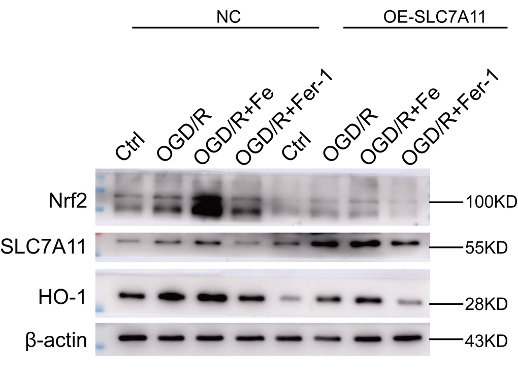 Low levels of SLC7A11 alleviate cell death by upregulating Nrf2-HO-1, whereas SLC7A11 overexpression (OE-SLC7A11) enhanced cell death. (A) SLC7A11 overexpression downregulates Nrf2-HO-1. Western blot showing the level of protein expression in BEAS-2B cells. 