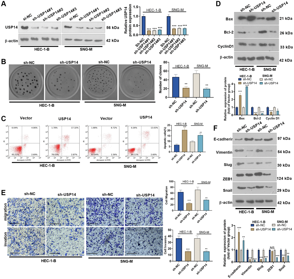 The effects of USP14 knockdown in the apoptosis, migration and invasion of EC cells. (A) sh-USP14 or sh-NC was transfected into HUC-1-B and SNG-M cells, and the USP14 profile in EC cell lines was examined by WB. (B) Colony formation of HEC-1-B and SNG-M cells was tracked by colony formation experiments. (C) FCM was used to observe apoptosis. (D) The expression levels of Bcl-2, Bax, and Cyclin D1 were examined by WB. (E) Transwell assays were implemented to evaluate EC cell migration and invasion. (F) E-cadherin, Vimentin, Snail1, ZEB1, and Slug profiles were examined by WB. NS, *, **, ***indicate P > 0.05, P P P N = 3.