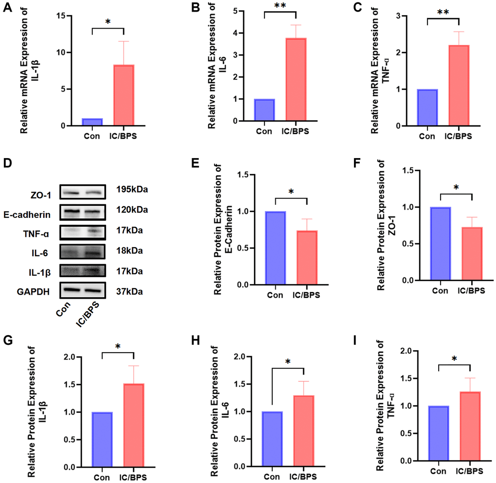 The construction of an IC/BPS model. (A–C) The qPCR showed that the expression levels of IL-1β, IL-6, and TNF-α were significantly higher in the lipopolysaccharide-induced IC/BPS model compared to Con. (D) Western blot analysis of ZO-1, E-cadherin, IL-1β, IL-6, TNF-α. (E–I) Relative protein expression of E-cadherin, ZO-1, IL-1β, IL-6, TNF-α. Results were presented as mean ± SD. *P **P 