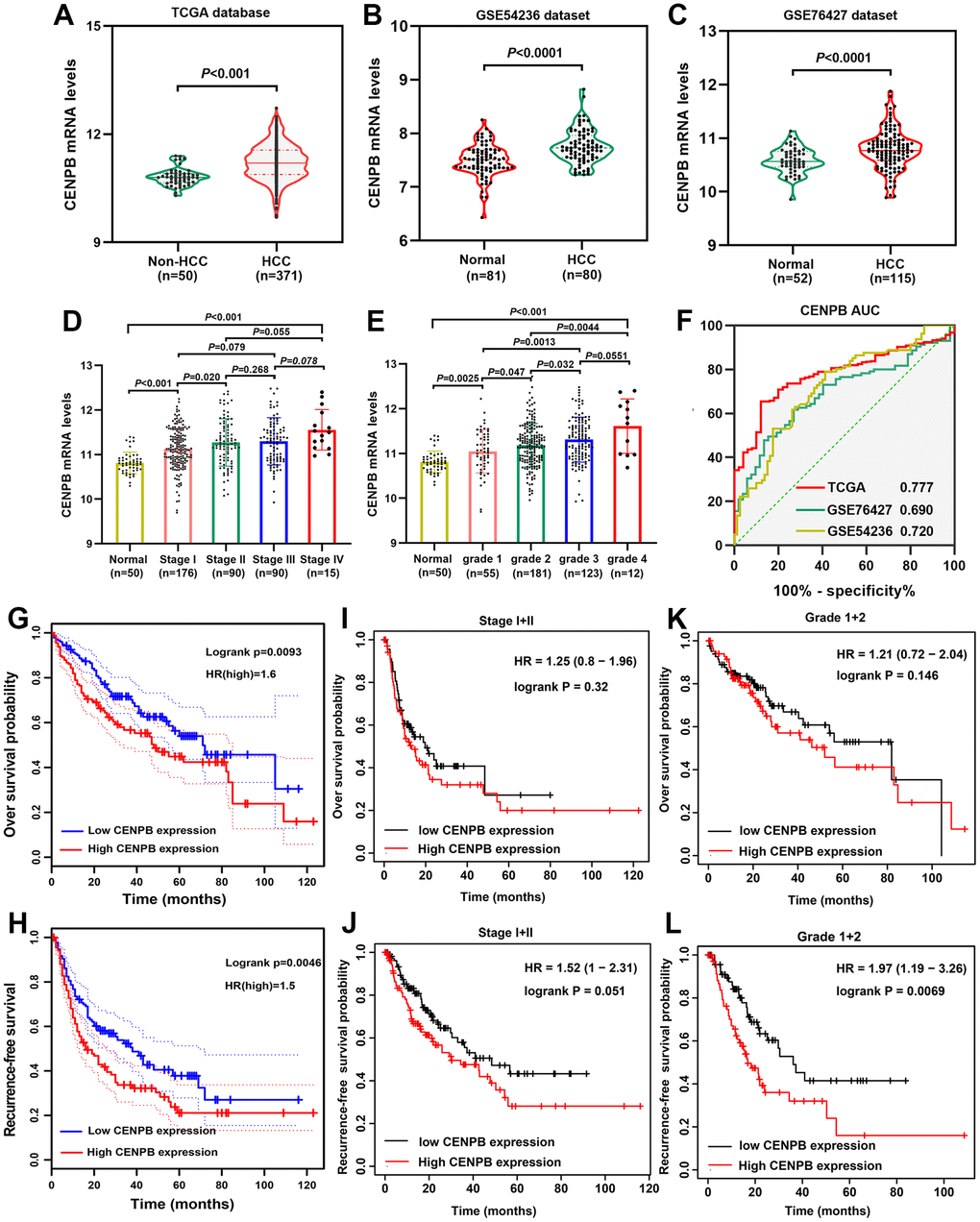 Prognostic significance of CENPB mRNA in HCC. (A–C) CENPB mRNA was found to be higher in HCC compared to normal liver tissues, as observed in the TCGA (A), GSE54236 (B), and GSE76427 (C) datasets. (D) The diagnostic potential of CENPB was assessed using ROC curves in the TCGA, GSE54236, and GSE76427 datasets. (E, F) CENPB mRNA levels exhibited a gradual increase with advancing tumor stage (E) and grade (F). (G, H) Elevated CENPB mRNA levels were associated with poor OS (G) and RFS (H). (I, J) High CENPB mRNA levels were predictive of poor OS (I) and RFS (J) specifically in stage I/II patients. (K, L) High CENPB mRNA levels predicted unfavorable OS (K) and RFS (L) in grade I/II patients.