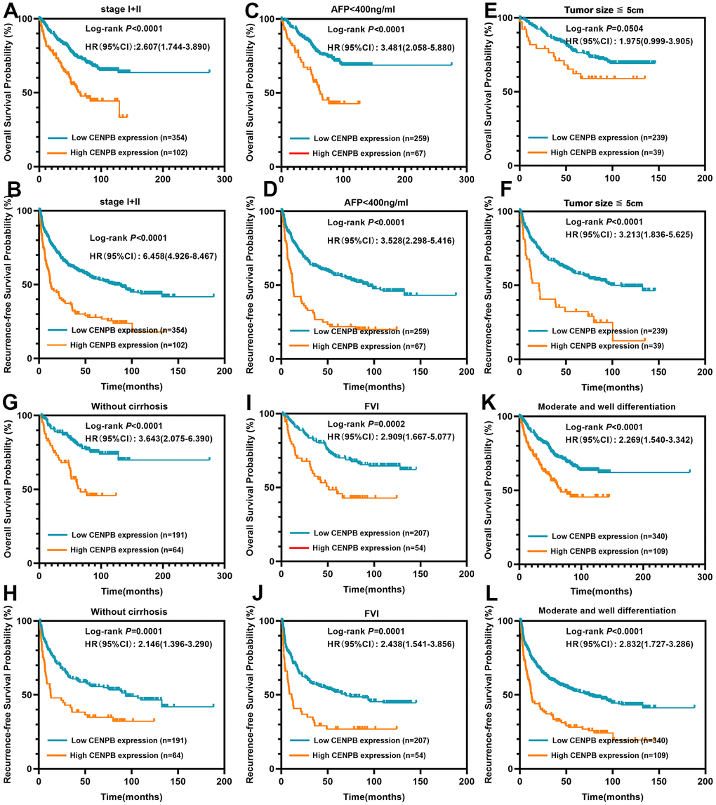 CENPB protein levels were found to be associated with the prognosis of patients within early-stage subgroups. (A, B) High CENPB protein expression predicted a shorter OS (A) and RFS (B) time for patients in stage I/II. (C, D) High CENPB protein expression predicted a shorter OS (C) and RFS (D) time for patients with AFP E, F) High CENPB protein expression predicted a shorter OS (E) and RFS (F) time for patients with tumor size smaller than 5cm. (G, H) High CENPB protein expression predicted a shorter OS (G) and RFS (H) time for without cirrhosis patients. (I, J) High CENPB protein expression predicted a shorter OS (I) and RFS (J) time for patients with free of vascular invasion. (K, L) High CENPB protein expression predicted a shorter OS (K) and RFS (L) time for patients with median/well differentiation.