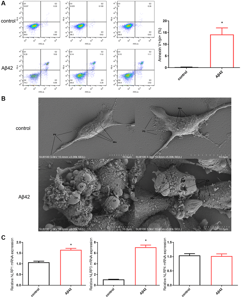 Aβ42 induces astrocyte pyroptosis. (A) Astrocytes were stimulated with the 1 μmol Aβ42 for 48 h were harvested for PI staining and flow cytometry analysis. (B) Scanning electron microscopy was performed to observe astrocyte pyroptosis in the control and Aβ42 groups. (C) Real-time quantitative PCR was used to detect the expression of astrocyte pyroptosis-associated inflammasomes (NLRP1, NLRP3, NLRP4) in the control and Aβ42 groups. *p 