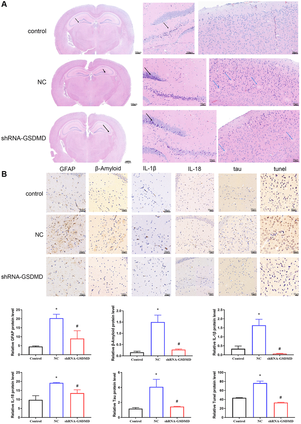 Inhibition of astrocyte pyroptosis can alleviate brain tissue lesions in APP/PS1 mice. (A) H&E staining of brain tissues. (B) Immunohistochemical analysis and protein expression of each group of GFAP, Aβ, IL-1β, IL-18, tau, and tunnel.