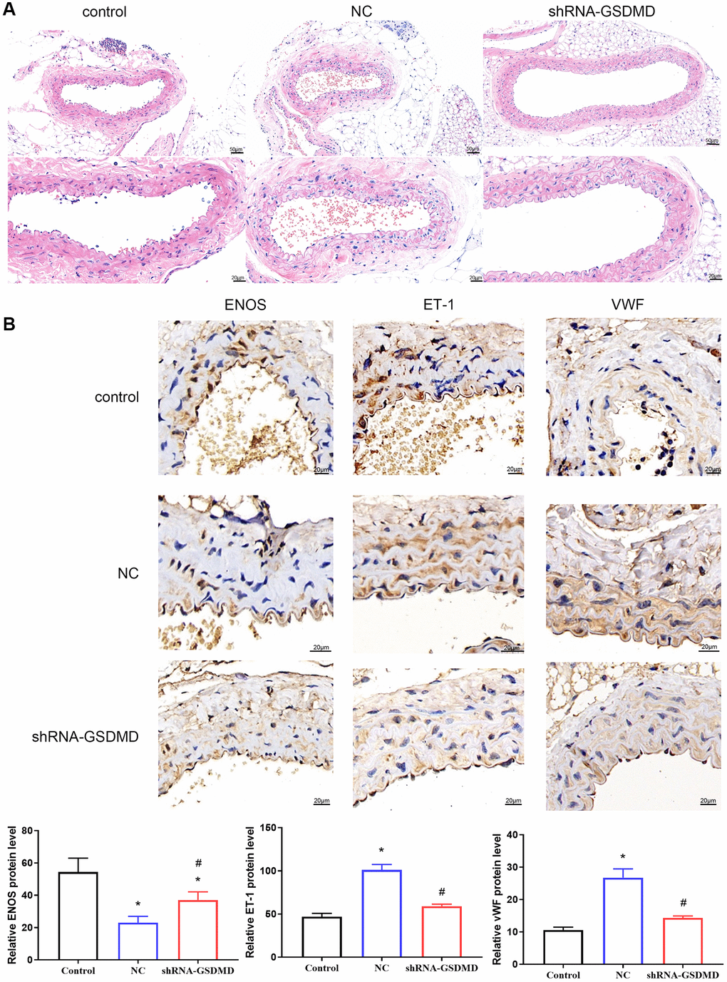 Inhibition of astrocyte pyroptosis can alleviate vascular lesions in APP/PS1 mice. (A) H&E staining of aortic tissue. (B) Immunohistochemical analysis and protein expression of each group of eNOS, ET-1, and vwF.