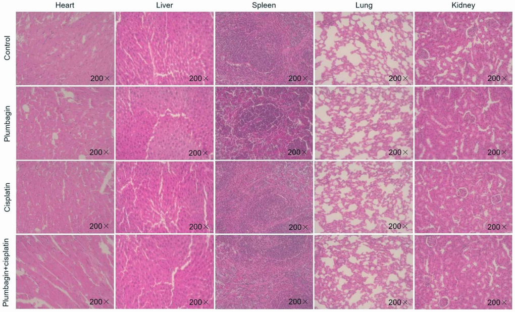 The hearts, livers, spleens, lungs and kidneys of mice in each model group were sliced and stained with H&E. Magnification × 200.