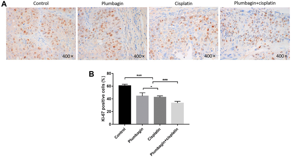 Anti-proliferative effect of plumbagin on TSCC PDX model. Ki67 IHC analysis was performed on each group of PDX models. (A) Use IHC to detect Ki67 expression. Nuclei of tumor cells were stained with hematoxylin (purple) and Ki67 positive cells have brown nuclei. (B) Quantitative analysis of Ki67 positive cells. Six 400X images were analyzed for each bar. Each bar represented the positivity cell rate, and the positivity cell rate was calculated as the ratio of the number of positive cells to the number of total cells. ***P 