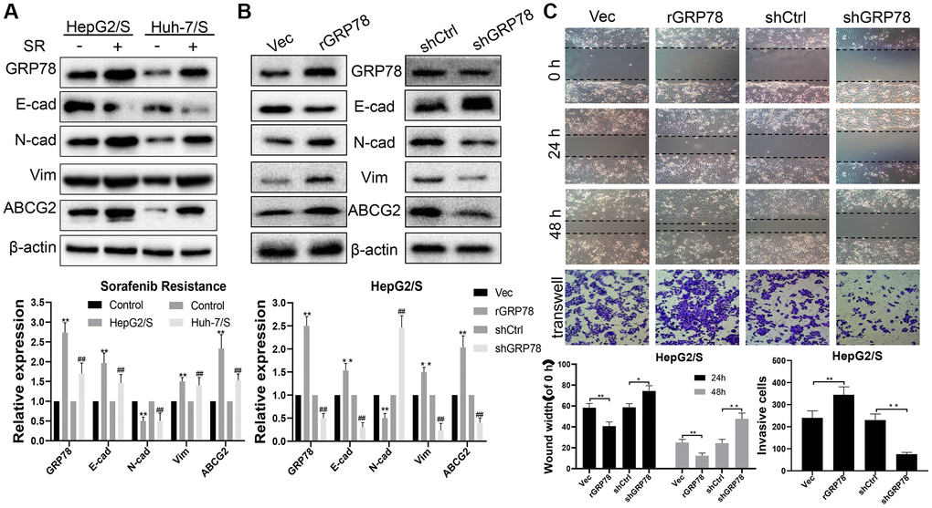 GRP78 is a key target that increases sorafenib resistance and promotes invasion and metastasis in liver cancer. (A) The effect of sorafenib on the expression of proteins in SR-HCC. The expression levels of proteins (E-cadherin, N-cadherin, Vimentin, ABCG2 and GRP78) in HCC cells treated with sorafenib for 24 h. (B) The effects of GRP78 overexpression/knockdown on protein expression in HepG/S cells. (C) Effects of GRP78 overexpression/knockdown on migration and invasion of SR-HCC cells.