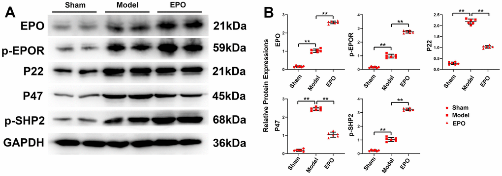 Protein expressions of EPO, p-EPOR, P22, P47 and p-SHP2 in the three groups. (A) Representative protein bands of EPO, p-EPOR, P22, P47 and p-SHP2 in hippocampus of the three groups. (B) Relative protein expressions of EPO, p-EPOR, P22, P47 and p-SHP-2 in hippocampus of the three groups. **P