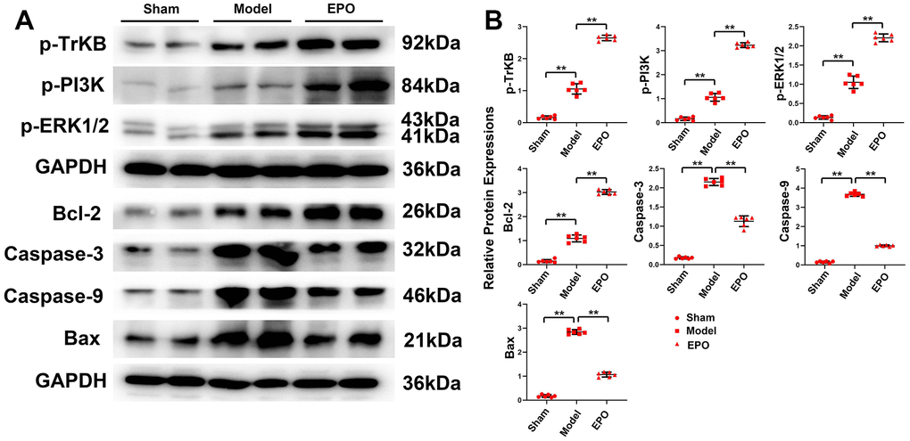 Expressions of BDNF/TrKB/PI3K/ERK1/2 axis and apoptosis-related proteins, and apoptosis of hippocampal neurons in the three groups. (A) Representative protein bands of p-TrKB, p-PI3K, p-ERK1/2, Bcl-2, Bax, Caspase-9 and Caspase-3 in hippocampus of the three groups; (B) Relative protein expressions of p-TrKB, p-PI3K, p-ERK1/2, Bcl-2, Bax, Caspase-9, and Caspase-3 in hippocampus of the three groups; **P