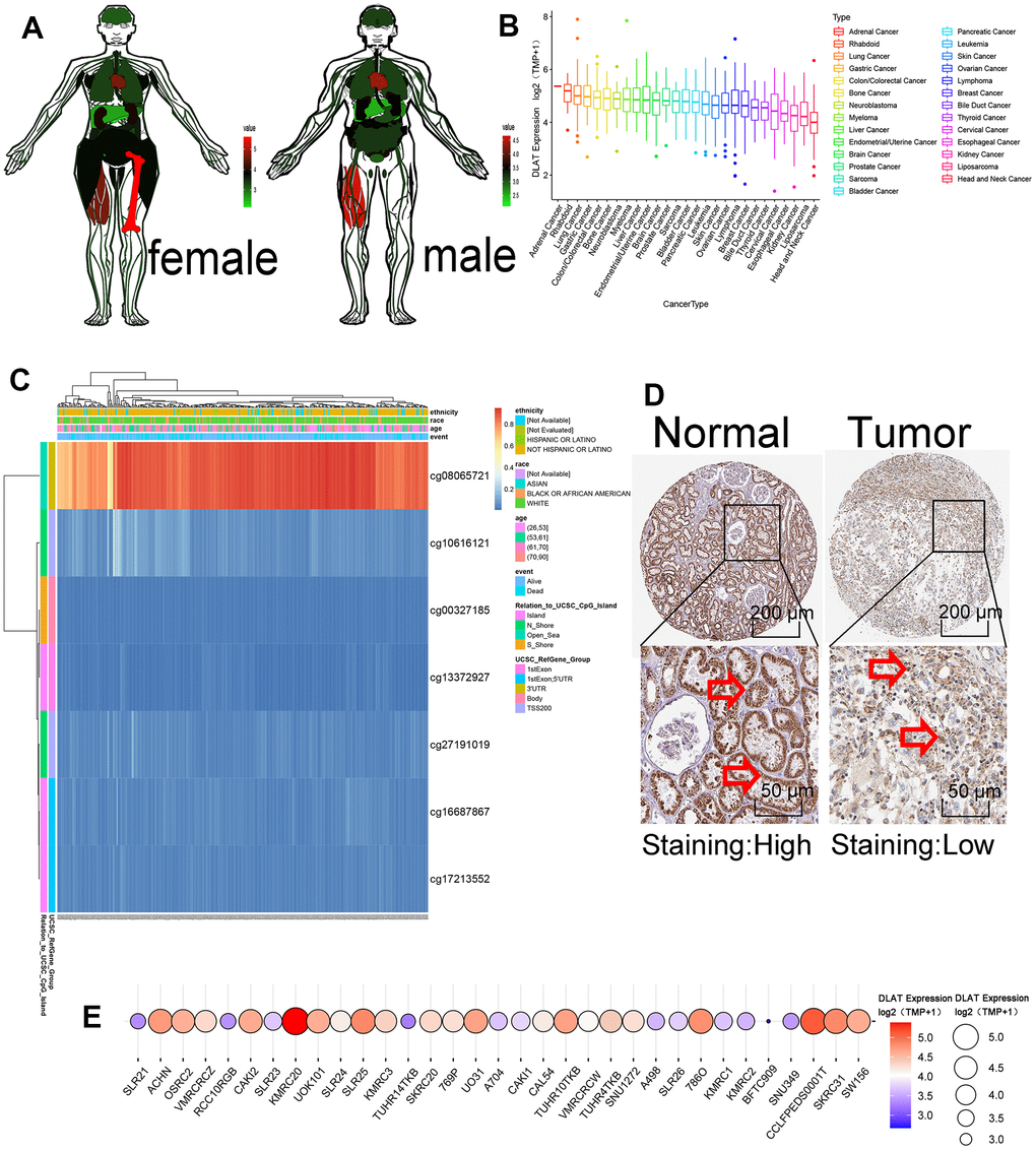 Methylation and protein expressions of DLAT. (A) DLAT expression levels in various human tissues. Red represents high expression and green represents low expression. (B) The expression level of DLAT in each tumor cell line. Decreased expression from left to right. (C) DNA methylation hot diagram of DLAT. Red represents high expression and blue means low expression. (D) DLAT protein level based on Human Protein Atlas. Normal tissues are on the left, while tumor tissues are on the right. The arrow is marked with DLAT protein. (E) DLAT expression at 33 kidney cancer cell lines. Red represents high expression, and blue represents low expression. The size of the circle represents DLAT expression.