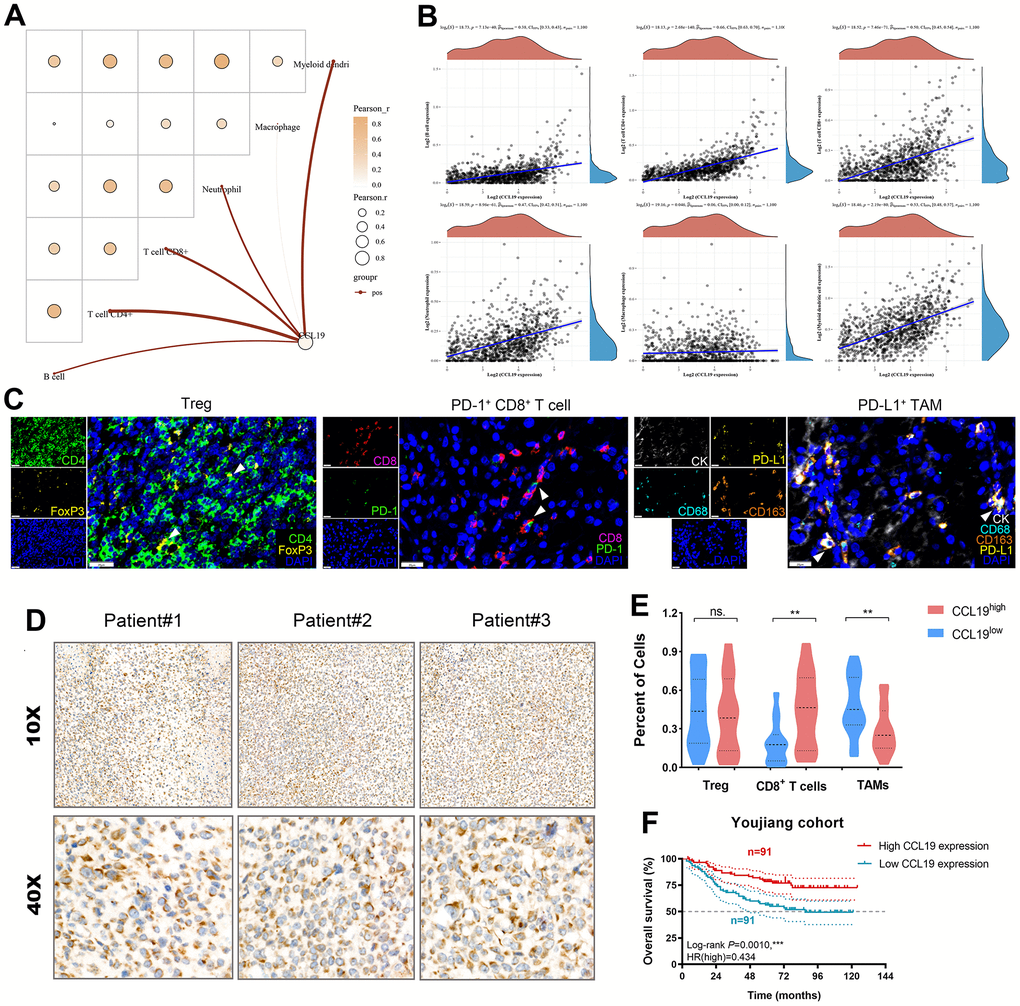 CCL19 modulates tumor immune microenvironment features and predicts prognosis in breast cancer patients. (A) We implemented with the CIBERSORT algorithms and identified prominently positive association between CCL19 expression and tumor-associated immune cells, including B cells, CD4+ T cells, CD8+ T cells, neutrophil, and myeloid dendritic cells. (B) Then, Sperman’s correlations between CCL19 expression and the immune cells infiltration were shown in the form of dot plots. (C) Multiplex fluorescence was implemented to identify Treg, CD8+ T cells, and PD-L1+ macrophages. (D) IHC staining of CCL19 in a total of 182 patients with breast cancer. (E) Differential percent of specific cells were compared between CCL19 expression groups using Student’s t test. (F) Kaplan-Meier survival analysis revealed that higher expression of CCL19 significantly predicts long-term outcomes for breast cancer patients.