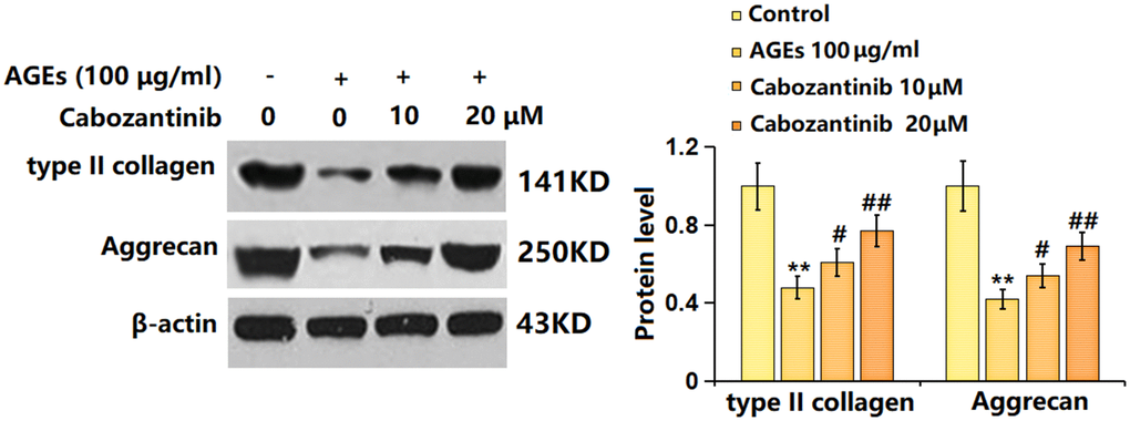 Cabozantinib increased type II collagen and aggrecan levels in AGEs-treated SW1353 chondrocytes. SW1353 chondrocytes were stimulated with 100 μg/ml AGEs with or without 10 and 20 μM Cabozantinib for 24 h. The type II collagen and Aggrecan levels were detected by the Western blotting assay (n=6, *, ** PP