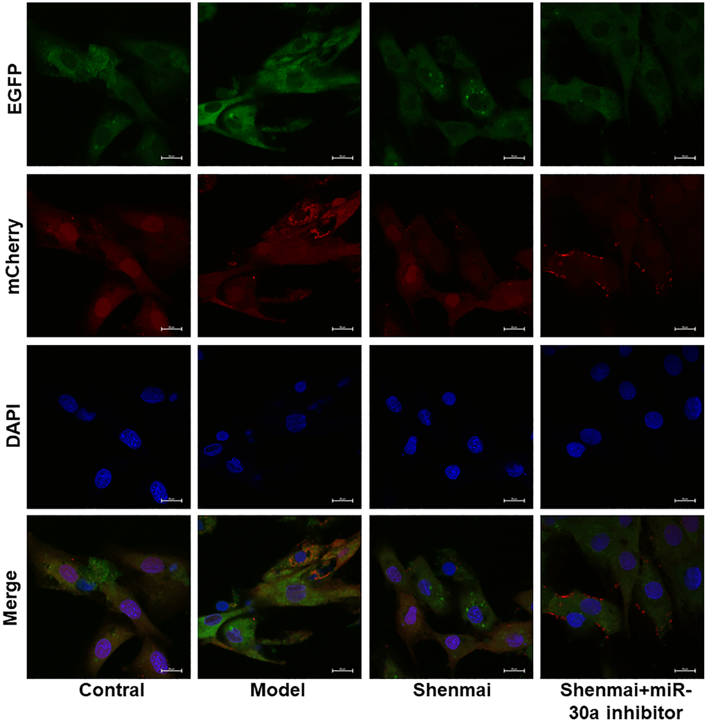 Effect of Shenmai injection on autophagy flow of H9c2 cells.