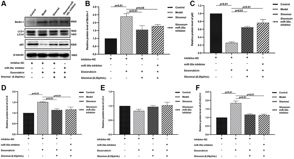 Effects of Shenmai injection on the expression of autophagy-related proteins in H9c2 cells. (A) Western Blot; (B) The expression of Beclin-1 protein; (C) The expression of p62 protein; (D) The expression of LC3-II protein; (E) The expression of LC3-I protein; (F) The expression of LC3-II/LC3-I protein.