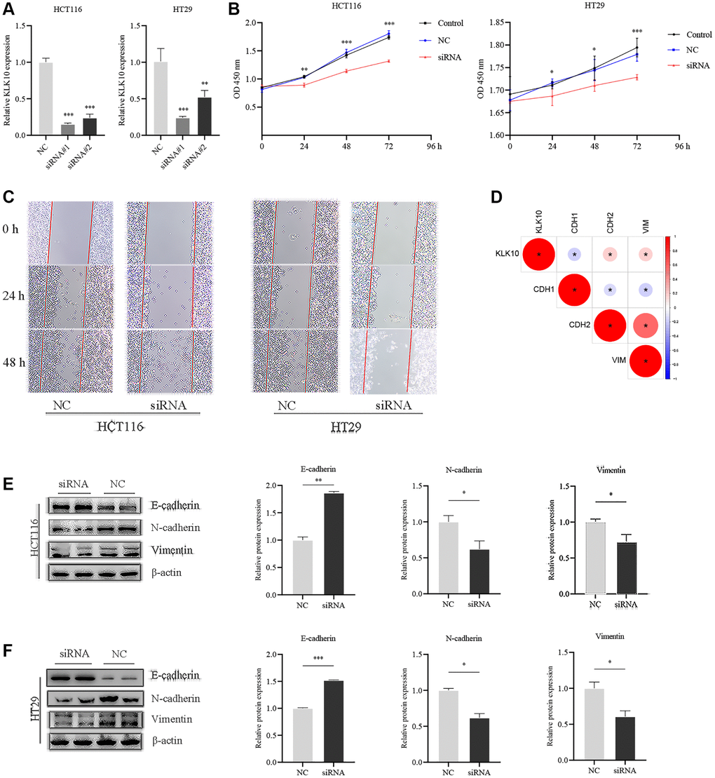 Influences of KLK10 expression on CRC cell proliferation, migration, and invasion. (A) The efficacy of the KLK10 transcript was detected after KLK10 knockdown in two CRC cell lines. (B) Cell viability was assessed by CCK8 array when KLK10 expression was reduced in cells. (C) Wound-healing assay of CRC cells with KLK10 knockdown monitored for 48-h with 24-h intervals. (D) Correlations between KLK10 expression and EMT markers (E-cadherin, N-cadherin, and Vimentin) using Spearman analysis. (E, F) The protein levels of E-cadherin, N-cadherin, and Vimentin were measured by western blotting after KLK10 knockdown in two CRC cell lines. Data are presented as mean ± SD. *P **P ***P 