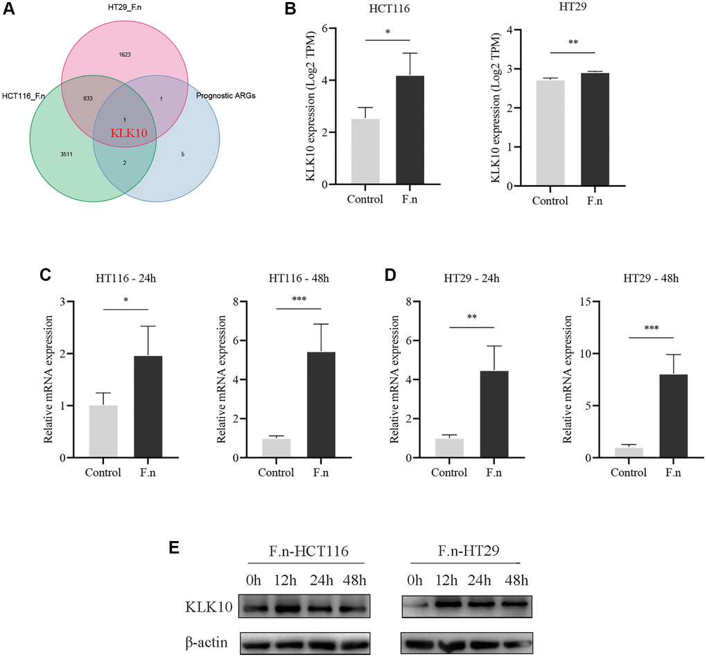 CRC cells co-cultured with F.n were found to have significantly upregulated KLK10 expression. (A) The Venn diagram demonstrating that KLK10 was shared by F.n infection-related DEGs and prognostic ARGs. (B) Microarray analysis of KLK10 expression between HCT116 cells and F.n infected HCT116 cells (left panel) and expression of KLK10 in HT29 cells incubated with or without F.n (right panel). (C, D) The KLK10 mRNA expression in CRC cell lines infected with or without F.n for 24 h and 48 h, respectively, was determined by qPCR. (E) Representative western blot for KLK10 protein and β-actin protein extracted from CRC cells infected with F.n for 0, 12, 24, and 48 h. *P **P ***P 