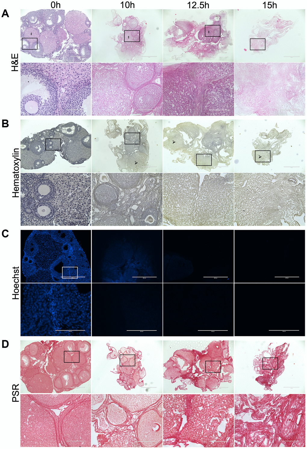 Treatment with 0.1% SDS enriches for the ovarian ECM in 12.5 hours. Representative images of H&E (A), Hematoxylin (B), Hoechst (C), and PSR (D) stained ovarian tissue sections following treatment with 0.1% SDS for 0 h (native), 10 h, 12.5 h, or 15 h. Bottom row of each panel is optical zoom of boxed region from top row. Scale bar for top row for each panel = 400 μm. Scale bar for bottom row for each panel = 100 μm. N = 3–4 ovaries per group. Example of a corpus luteum indicated by ‡ in H&E-stained images. Example of region without nuclei indicated by arrows in Hematoxylin-stained images.