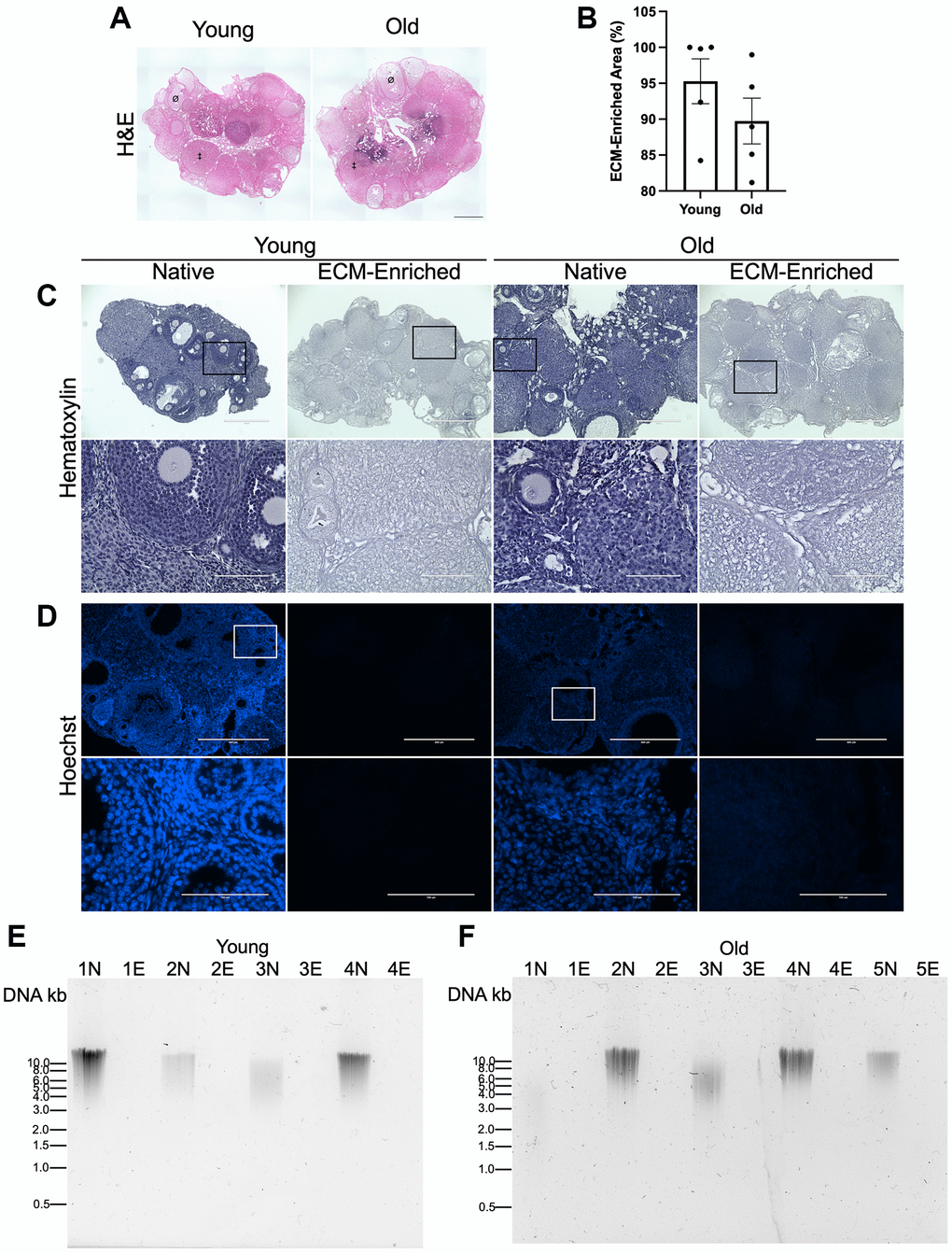 ECM-enrichment was effective in ovaries from reproductively young and reproductively old mice. (A) Representative scans of ovarian tissue sections from reproductively young and old mice stained with H&E following treatment with 0.1% SDS for 12.5 h. Example of a follicle indicated by Ø and example of a corpus luteum indicated by ‡. (B) Quantification of relative ECM-enriched area (%). (C, D) Representative images of Hematoxylin (C) and Hoechst (D) stained ovarian tissue sections from reproductively young and old mice following treatment with 0.1% SDS for 0 h (Native) or 12.5 h (ECM-enriched). Bottom row of each panel is optical zoom of boxed region from top row. Scale bar for top row for each panel = 400 μm. Scale bar for bottom row for each panel = 100 μm. (E, F) Images of agarose gel electrophoresis of DNA extracted from native (N) and ECM-enriched (E) ovaries from reproductively young (E) and old (F) mice. Numbers (ex: 1N and 1E) correspond to ovaries from the same mouse. Samples run with 1 kb DNA ladder. N = 4–5 ovaries per group.