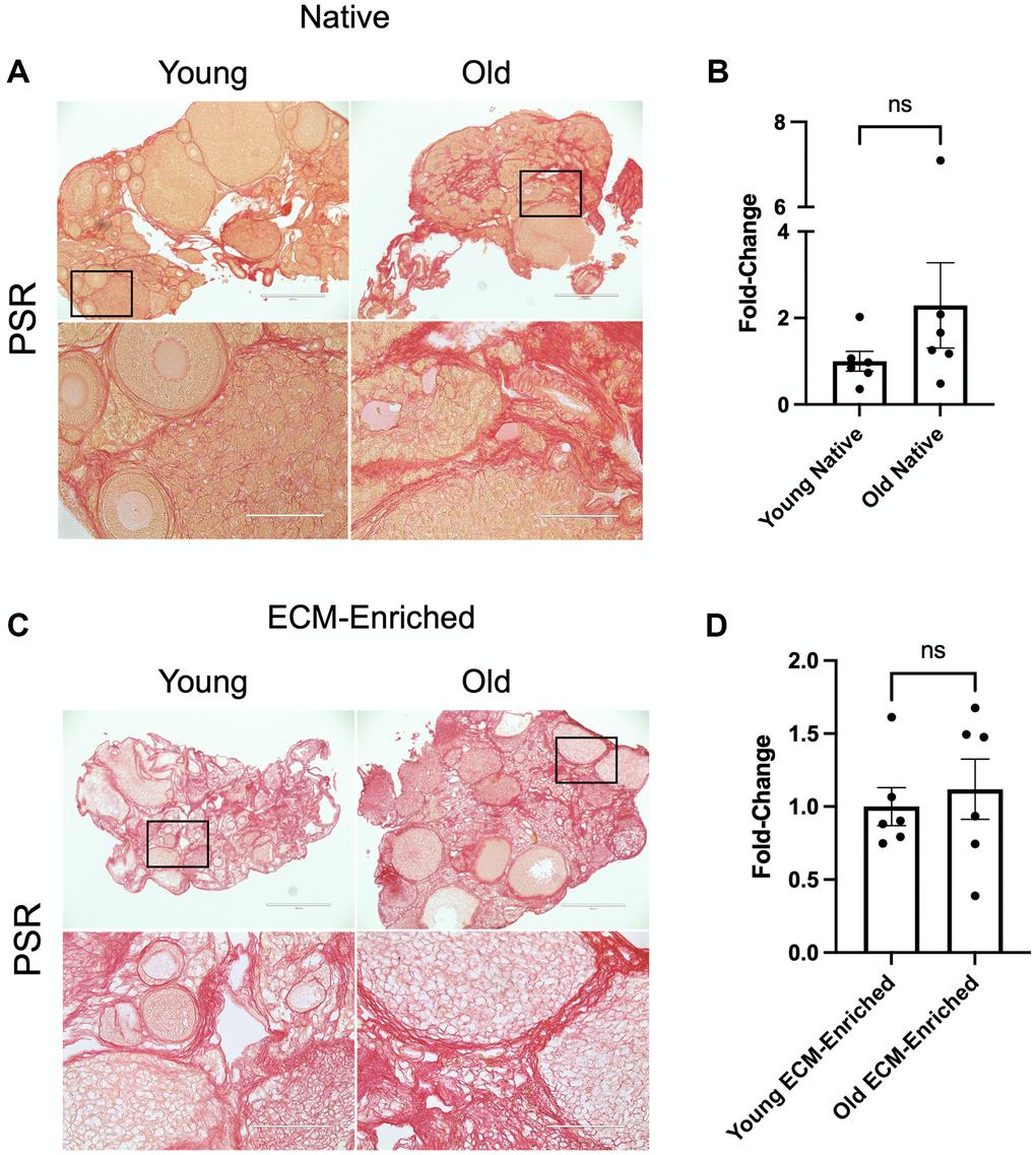 ECM-enrichment maintains collagen I and III. (A, C) Representative images of PSR stained ovarian tissue sections from reproductively young and old mice following treatment with 0.1% SDS for 0 h (A, Native) or 12.5 h (C, ECM-enriched). Bottom row of each panel is optical zoom of boxed region from top row. Scale bar for top row for each panel = 400 μm. Scale bar for bottom row for each panel = 100 μm. (B, D) Quantification of fold-change of relative PSR-positive ovarian area in native (B) and ECM-enriched (D) ovaries from reproductively old mice over young counterparts. N = 6 ovaries per group.