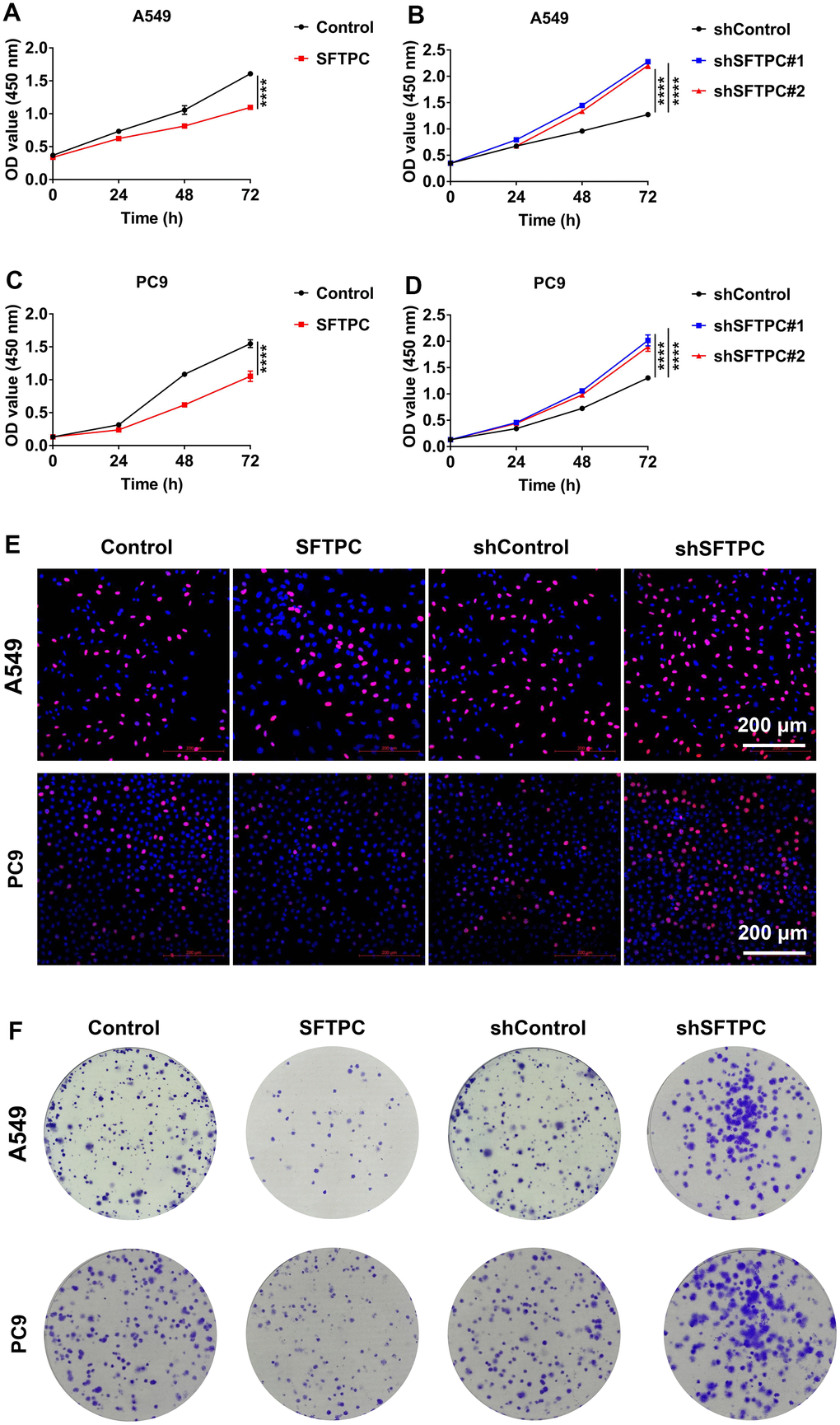 SFTPC can inhibit the proliferation of LUAD in vitro. (A–D) CCK-8 assay for A549 and PC9 cells stably overexpressing (A, C) or inhibiting SFTPC expression (B, D). (E) Immunofluorescence analysis of A549 and PC9 cells stably overexpressing or knocking down SFTPC. (F) Colony formation assays for A549 and PC9 cells stably overexpressing or knocking down SFTPC. *, P P P 