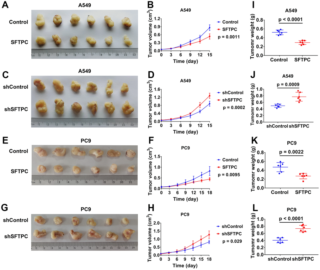SFTPC can inhibit the proliferation of LUAD in vivo. (A–D) Xenograft models and the tumor growth curves of LUAD tumor derived from A549 cells: overexpression of SFTPC significantly inhibited the proliferation of A549 cells in vivo (A, B), while knockdown of SFTPC significantly promoted their proliferation (C, D). (E–H) Xenograft models and the tumor growth curves of LUAD tumor derived from PC9 cells: overexpression of SFTPC significantly inhibited the proliferation of PC9 cells in vivo (E, F), while knockdown of SFTPC significantly promoted their proliferation (G, H). The volume of the tumor was measured every three days until the mice were euthanized, after which the tumor growth curves were drawn. (I–L) The weights of tumors were significantly decreased in the SFTPC overexpression groups (I–K), whereas they significantly increased in the SFTPC knockdown groups (J). After euthanizing the mice tumors were collected and weighed.