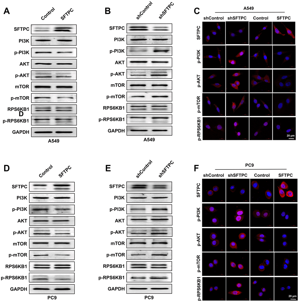 SFTPC can inhibit PI3K/AKT/mTOR signal transduction. (A–C) A549 cells overexpressing or knocking down SFTPC were subjected to Western blot (A, B) and immunofluorescence (C) assay. (D–F) A549 cells were subjected to Western blot (D, E) and immunofluorescence (F) assays while overexpressing or knocking down SFTPC.