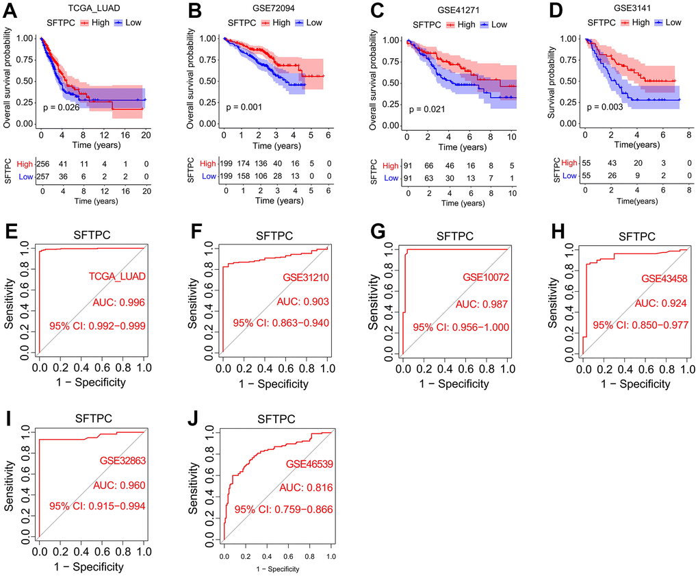 Correlation analysis between SFTPC and the incidence and prognosis of lung adenocarcinoma. (A–D) Kaplan-Meier curves of the OS of LUAD patients in the TCGA