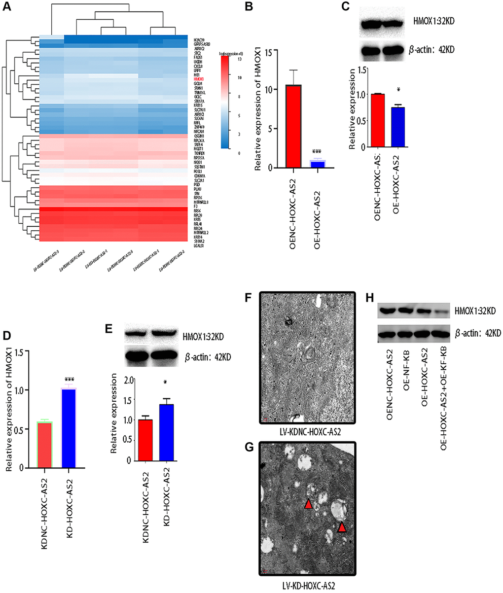 HOXC-AS2 affected the expression of HMOX1 by regulating the NF-KB signaling pathway and ultimately regulated autophagy in hypopharyngeal cancer cells. (A) Transcriptome sequencing was performed after HOXC-AS2 knockdown, and the heatmap shows the differentially expressed genes identified by sequencing. NC-transfected cells were used as controls. (B) The mRNA expression level of HMOX1 was confirmed through qRT-PCR analysis after HOXC-AS2 overexpression. (C) The protein expression level of HMOX1 was confirmed through western blot analysis after HOXC-AS2 overexpression. (D) The mRNA expression level of HMOX1 was confirmed through qRT-PCR analysis after HOXC-AS2 knockdown. (E) The protein expression level of HMOX1 was confirmed through western blot analysis after HOXC-AS2 knockdown. (F, G) Autophagosome formation in hypopharyngeal cancer cells after HOXC-AS2 knockdown was observed by transmission electron microscopy, and NC-transfected cells were used as controls. (H) The protein expression level of HMOX1 was affected by HOXC-AS2 and NF-KB.